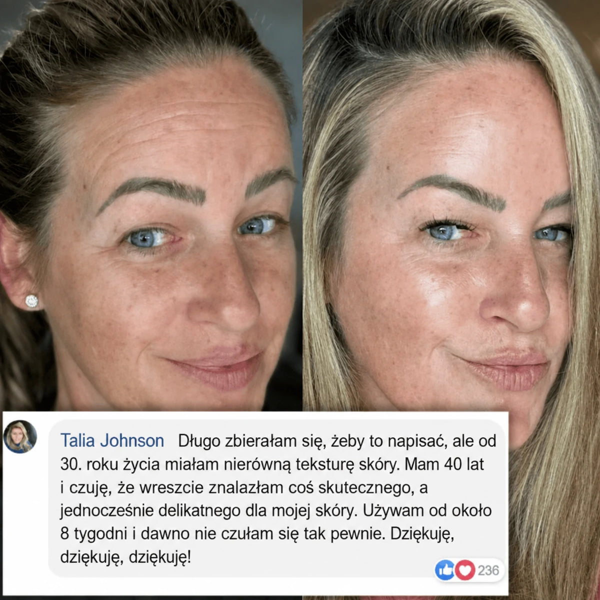 Balsam z PDRN