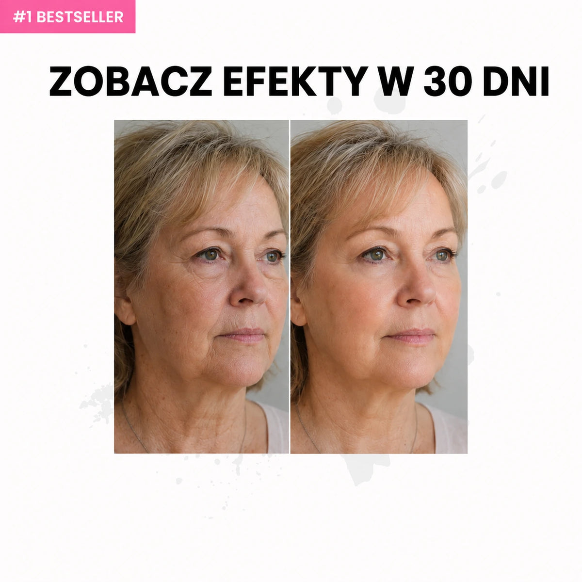 Balsam z PDRN