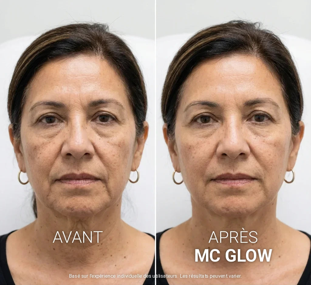 MC Glow™ Sérum Repulpant Volufiline