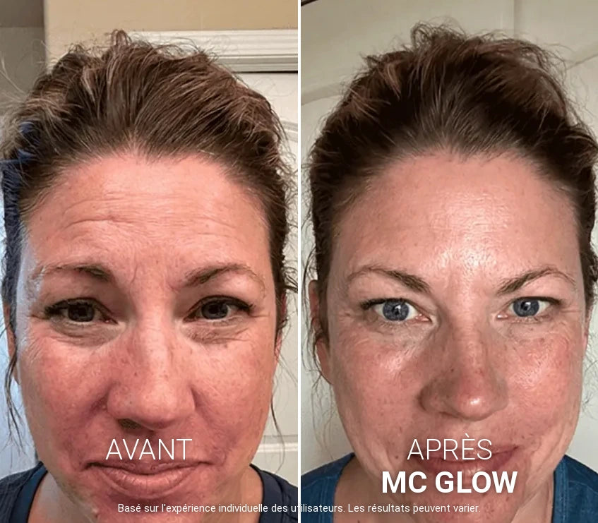 MC Glow™ Sérum Repulpant Volufiline