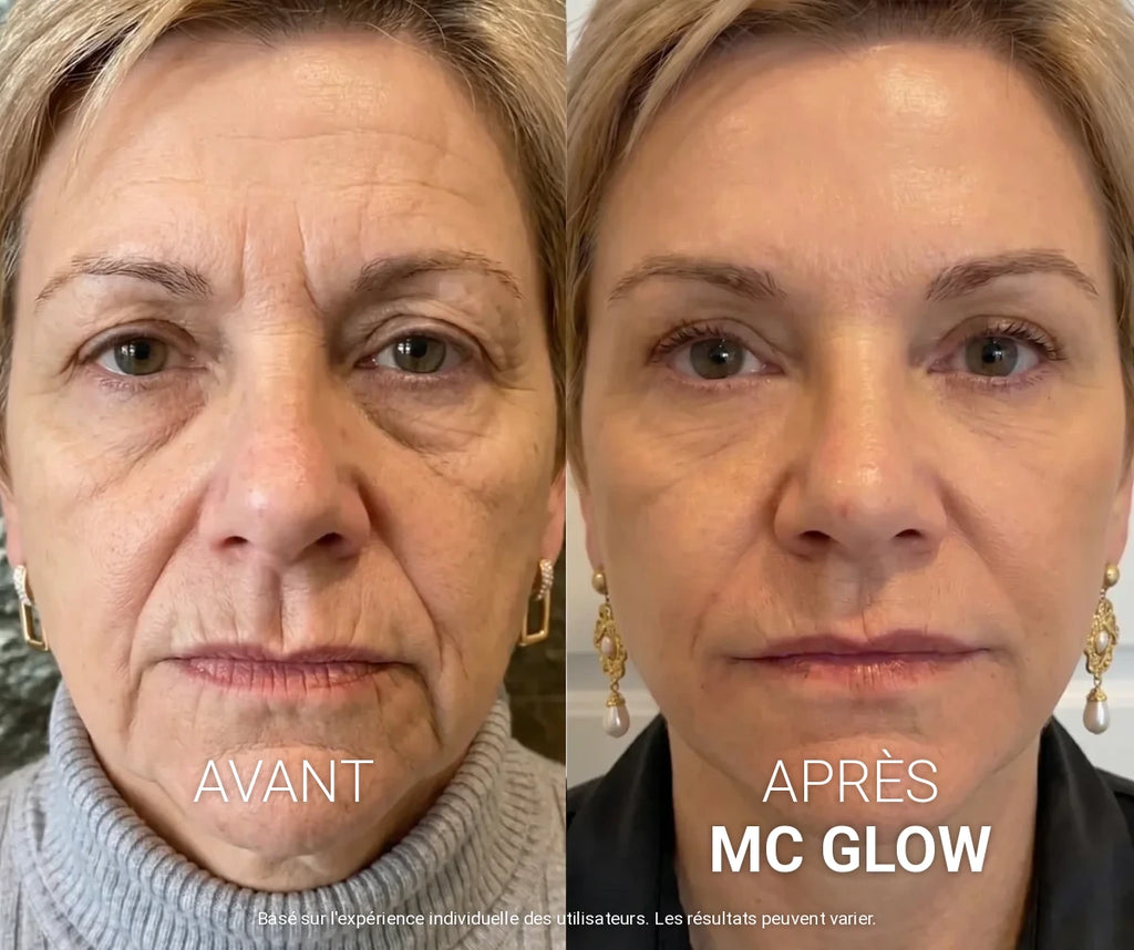 MC Glow™ Sérum Repulpant Volufiline